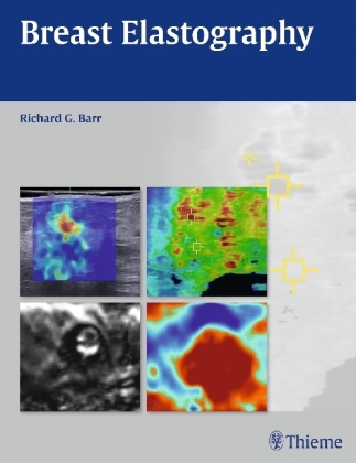 Breast Elastography