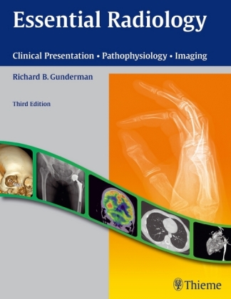 Essential Radiology