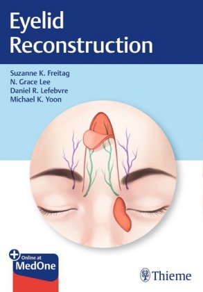 Eyelid Reconstruction